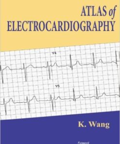 Atlas of Electrocardiography