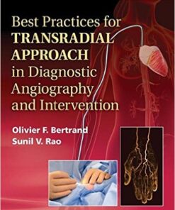 Best Practices for Transradial Approach in Diagnostic Angiography and Intervention