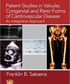 Patient Studies in Valvular, Congenital and Rarer Forms of Cardiovascular Disease: An Integrative Approach