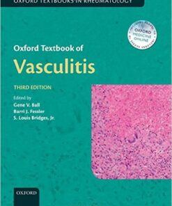 Oxford Textbook of Vasculitis