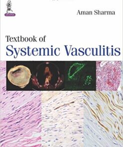 Textbook of Systemic Vasculitis