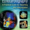 Echocardiography : A Practical Guide for Reporting and Interpretation, Third Edition