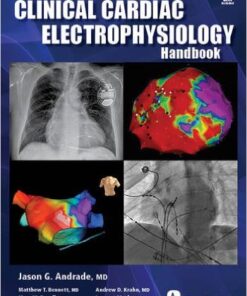 The Clinical Cardiac Electrophysiology Handbook