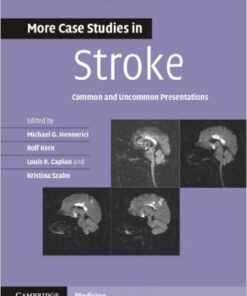 More Case Studies in Stroke: Common and Uncommon Presentations