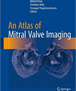 An Atlas of Mitral Valve Imaging