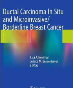 Ductal Carcinoma In Situ and Microinvasive/Borderline Breast Cancer