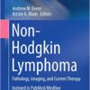 Non-Hodgkin Lymphoma