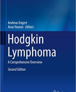 Hodgkin Lymphoma