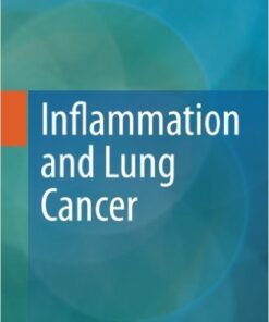 Inflammation and Lung Cancer