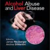 Alcohol Abuse and Liver Disease