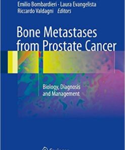 Bone Metastases from Prostate Cancer 2017 : Biology, Diagnosis and Management