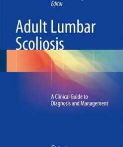 Adult Lumbar Scoliosis: A Clinical Guide to Diagnosis and Management 1st ed. 2017 Edition