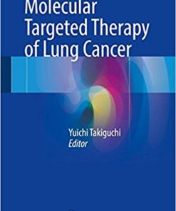 Molecular Targeted Therapy of Lung Cancer