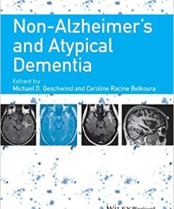 Non-Alzheimer’s and Atypical Dementia