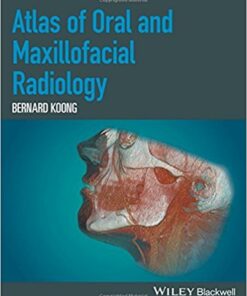 Atlas of Oral and Maxillofacial Radiology