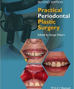 Practical Periodontal Plastic Surgery, 2nd Edition