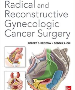 Radical and Reconstructive Gynecologic Cancer Surgery