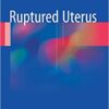 Ruptured Uterus