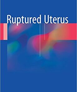 Ruptured Uterus