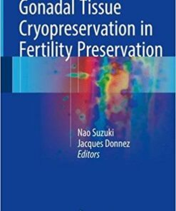 Gonadal Tissue Cryopreservation in Fertility Preservation 2016