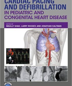 Cardiac Pacing and Defibrillation in Pediatric and Congenital Heart Disease