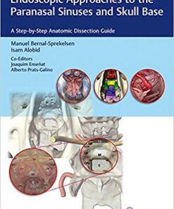 Endoscopic Approaches to the Paranasal Sinuses and Skull Base: A Step-by-Step Anatomic Dissection Guide 1st Edition PDF