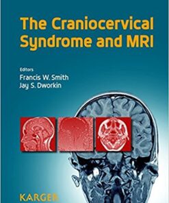 The Craniocervical Syndrome and MRI 1st Edition PDF