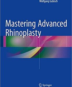 Mastering Advanced Rhinoplasty 1st ed. 2017 Edition PDF