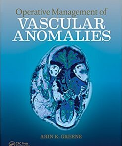 Operative Management of Vascular Anomalies 1st Edition PDF & VIDEO