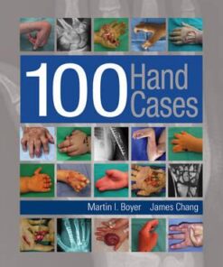 100 Hand Cases 1st Edition PDF