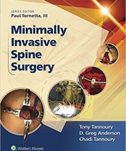 Minimally Invasive Spine Surgery PDF