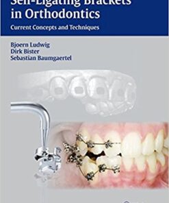 Self-ligating Brackets in Orthodontics: Current Concepts and Techniques 1st Edition PDF