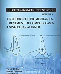 Orthodontic Biomechanics: Treatment Of Complex Cases Using Clear Aligner (Recent Advances in Dentistry) PDF