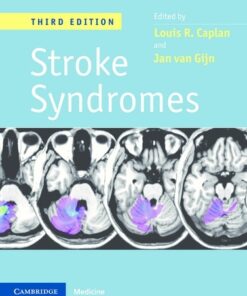 Stroke Syndromes, 3rd Edition PDF