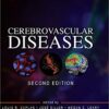 Primer on Cerebrovascular Diseases, Second Edition 2nd Edition PDF