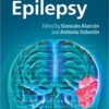 Introduction to Epilepsy (Cambridge Medicine PDF