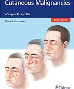 Cutaneous Malignancies: A Surgical Perspective 1st Edition PDF & VIDEO