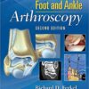 Foot & Ankle Arthroscopy Second Edition PDF