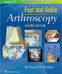 Foot & Ankle Arthroscopy Second Edition PDF