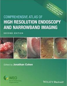 Comprehensive Atlas of High Resolution Endoscopy and Narrowband Imaging 2nd Edition (PDF)