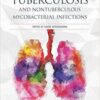 Tuberculosis and Nontuberculous Mycobacterial Infections, 7th edition  PDF