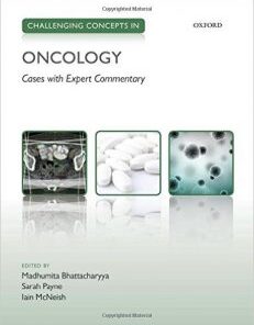 Challenging Concepts in Oncology Cases with Expert Commentary 1st Edition PDF