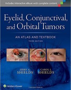 Eyelid, Conjunctival, and Orbital Tumors An Atlas and Textbook Third Edition PDF