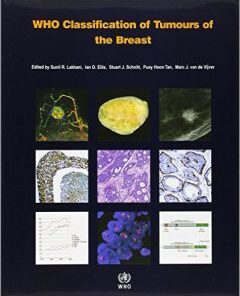 WHO Classification of Tumours of the Breast (IARC WHO Classification of Tumours) 4th Edition PDF