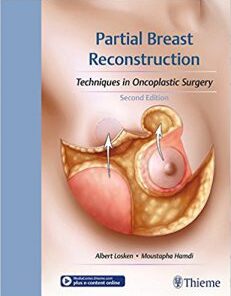 Partial Breast Reconstruction Techniques in Oncoplastic Surgery 2nd Edition PDF