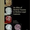 An Atlas of Skeletal Trauma in Medico-Legal Contexts PDF