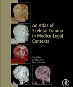 An Atlas of Skeletal Trauma in Medico-Legal Contexts PDF