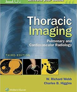 Thoracic Imaging: Pulmonary and Cardiovascular Radiology Third Edition by W. Richard Webb (Author),‎ Charles B. Higgins (Author)