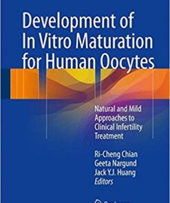 Development of In Vitro Maturation for Human Oocytes: Natural and Mild Approaches to Clinical Infertility Treatment 1st ed. 2017 Edition PDF