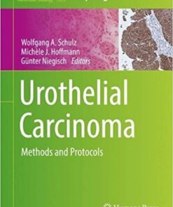 Urothelial Carcinoma: Methods and Protocols (Methods in Molecular Biology) 1st ed. 2018 Edition PDF